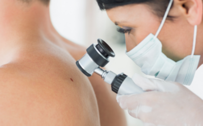 Savoir et Conseils Santé – Le cancer de la peau