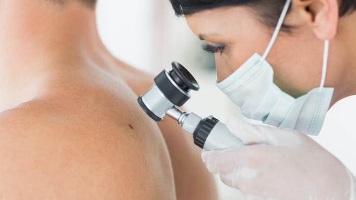 médecin qui examine la peau d'un patient